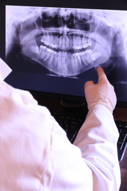 Best Emergency Wisdom Teeth Removal in Glenville, WV