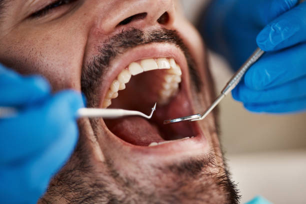Best Same-Day Emergency Dental Services in Glenville, WV
